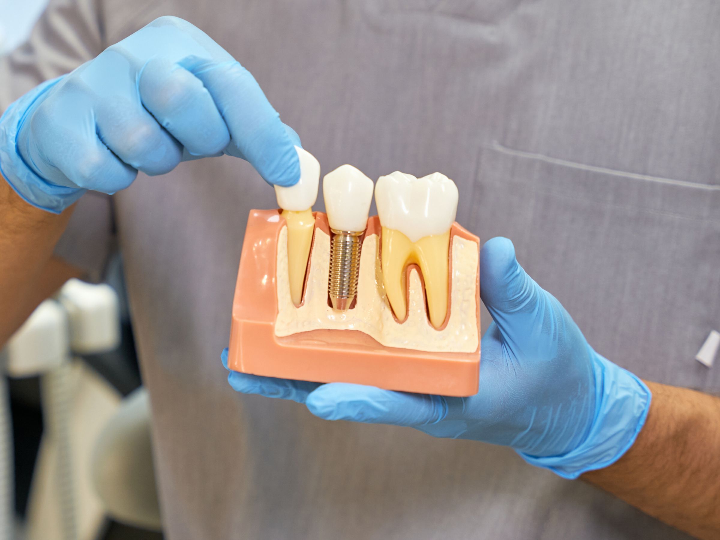 Dental Implants - Greater Essex Dental